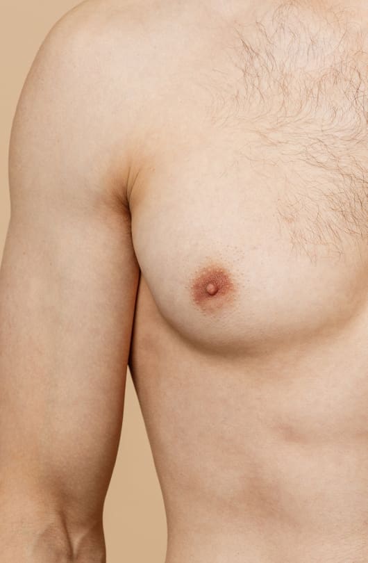 Inverted Nipple Surgery