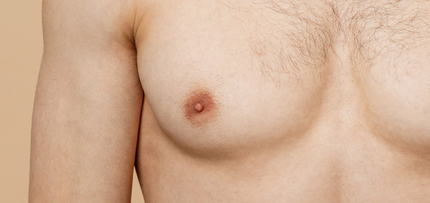 Inverted Nipple Surgery