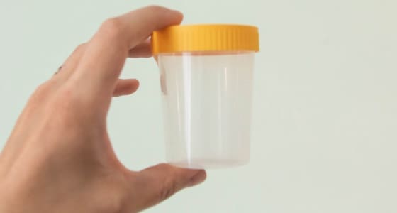 The Day Clinic - Urine Test