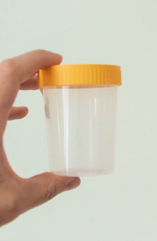 The Day Clinic - Urine Test