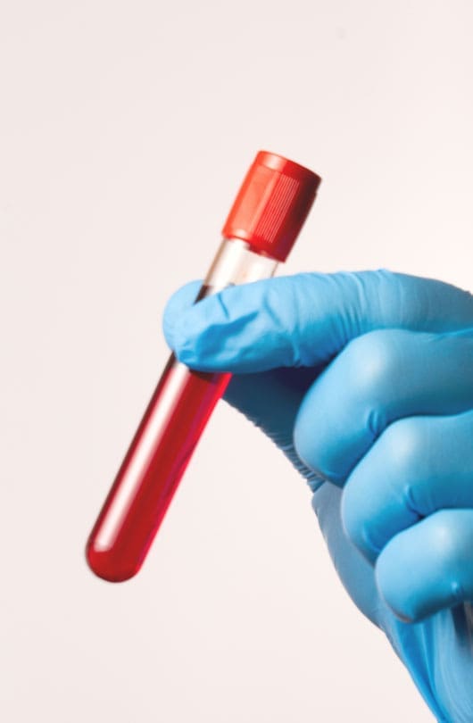 The Day Clinic - Urology - Blood Tests