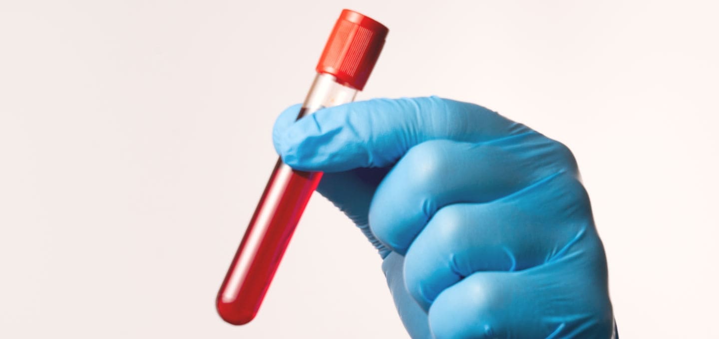 The Day Clinic - Urology - Blood Tests